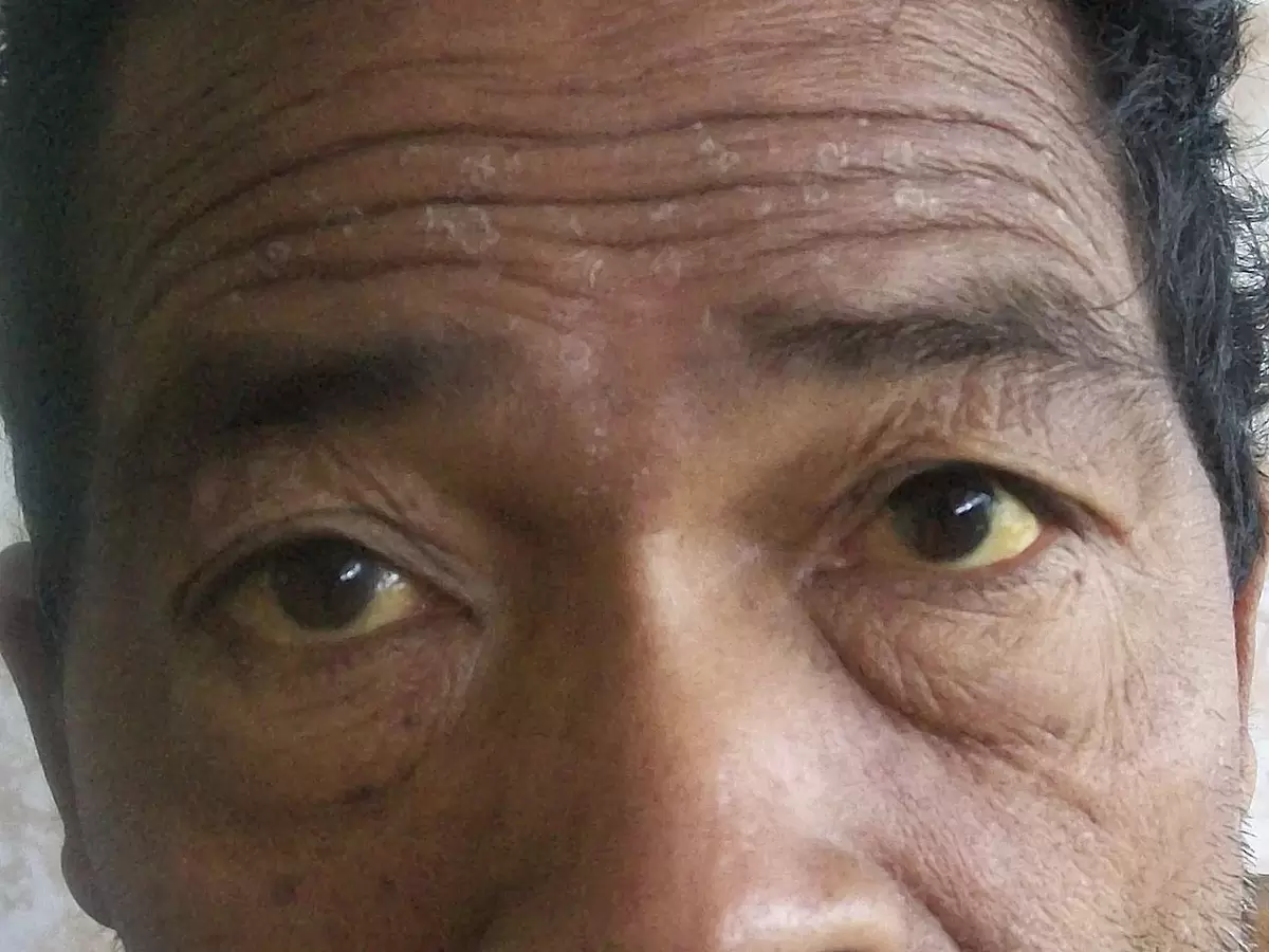 Как восстановить печень и вернуть коже свежесть без затрат на мази